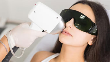 Laser Treatments