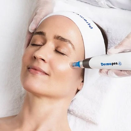 Dermapen Microneedling