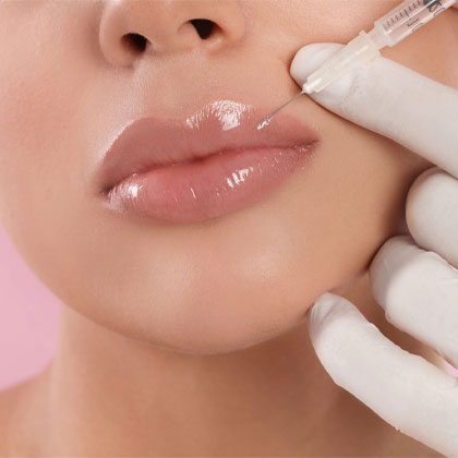 Lip Fillers in Dubai