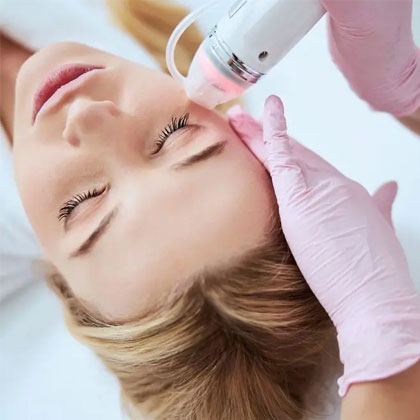 RF Microneedling