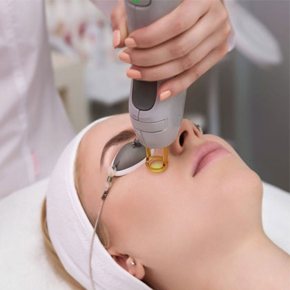 Fractional CO2 Treatment