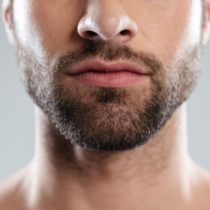 Beard Hair Transplant